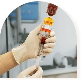 장갑 낀 손에 든 3단 챔버 키트와 주사기(아치 모양)